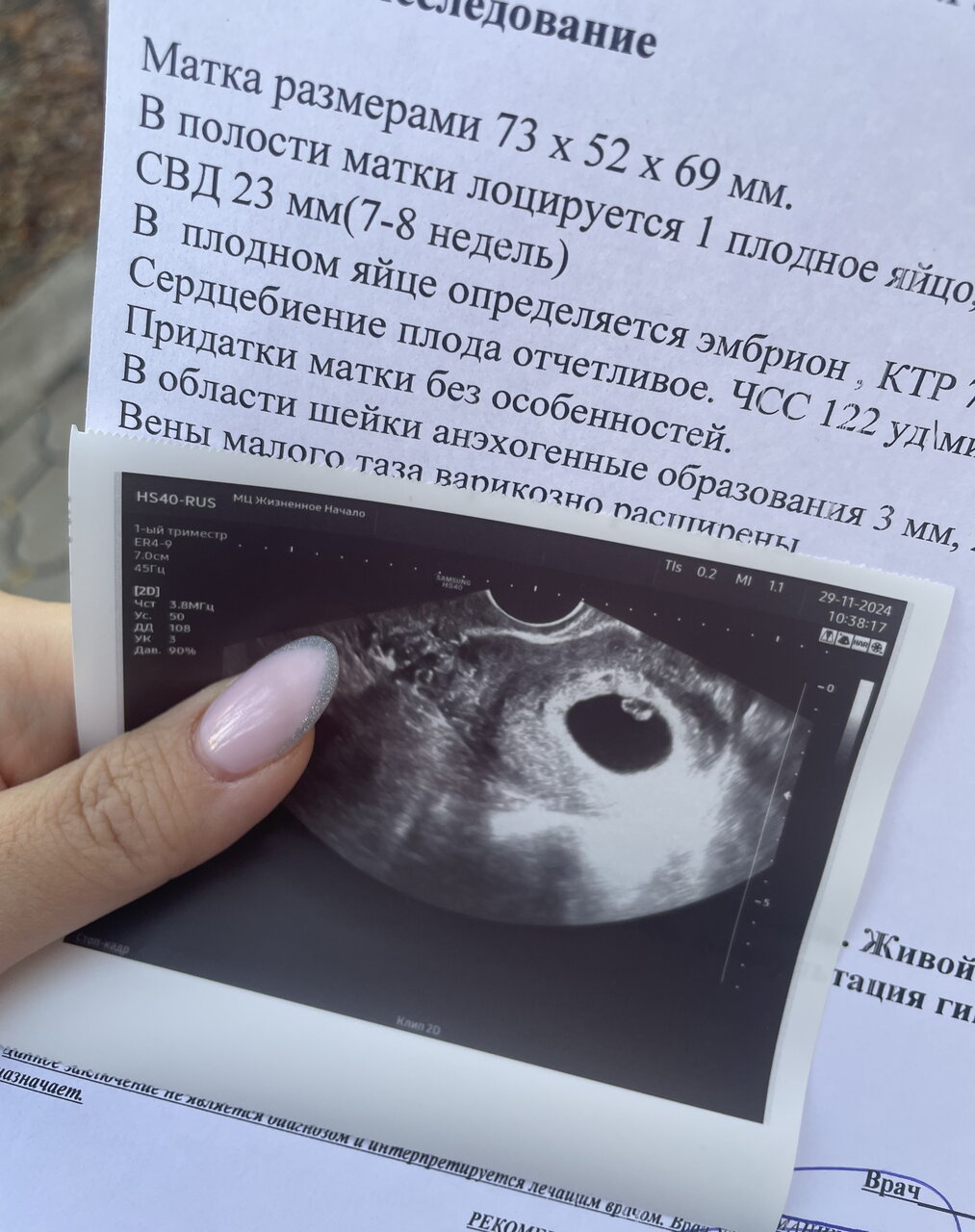 Узи