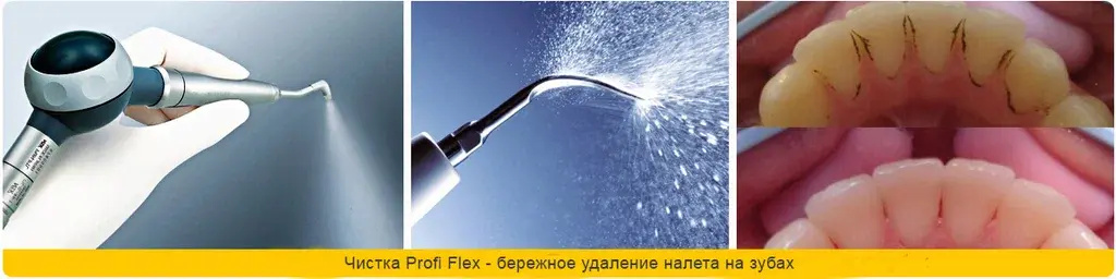 Ультразвуковая чистка зубов отзывы, зубы после нее не болят?