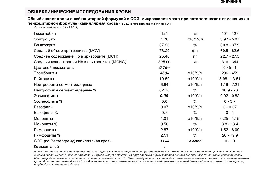 Анализ