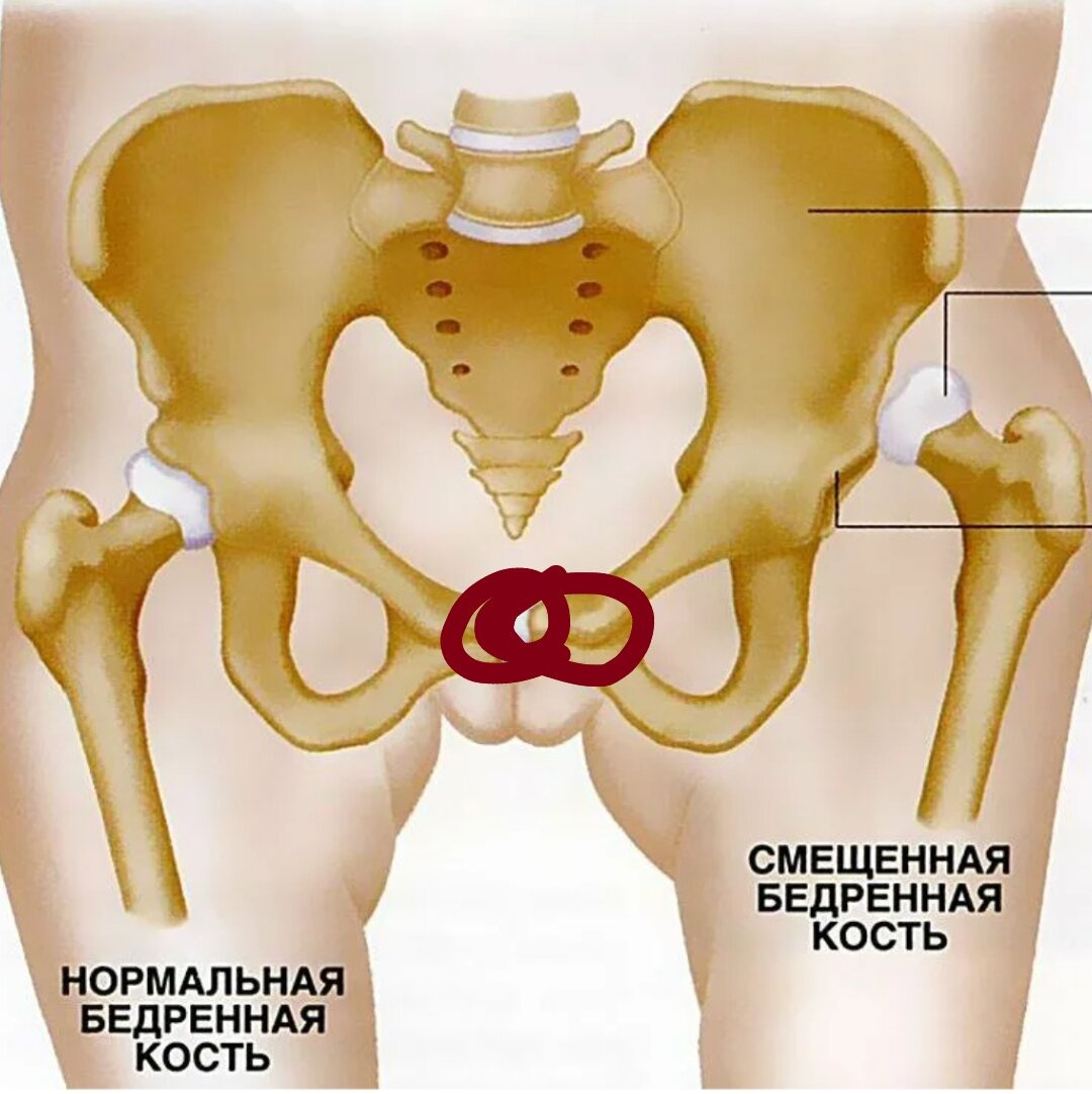 Болит там, где на фото