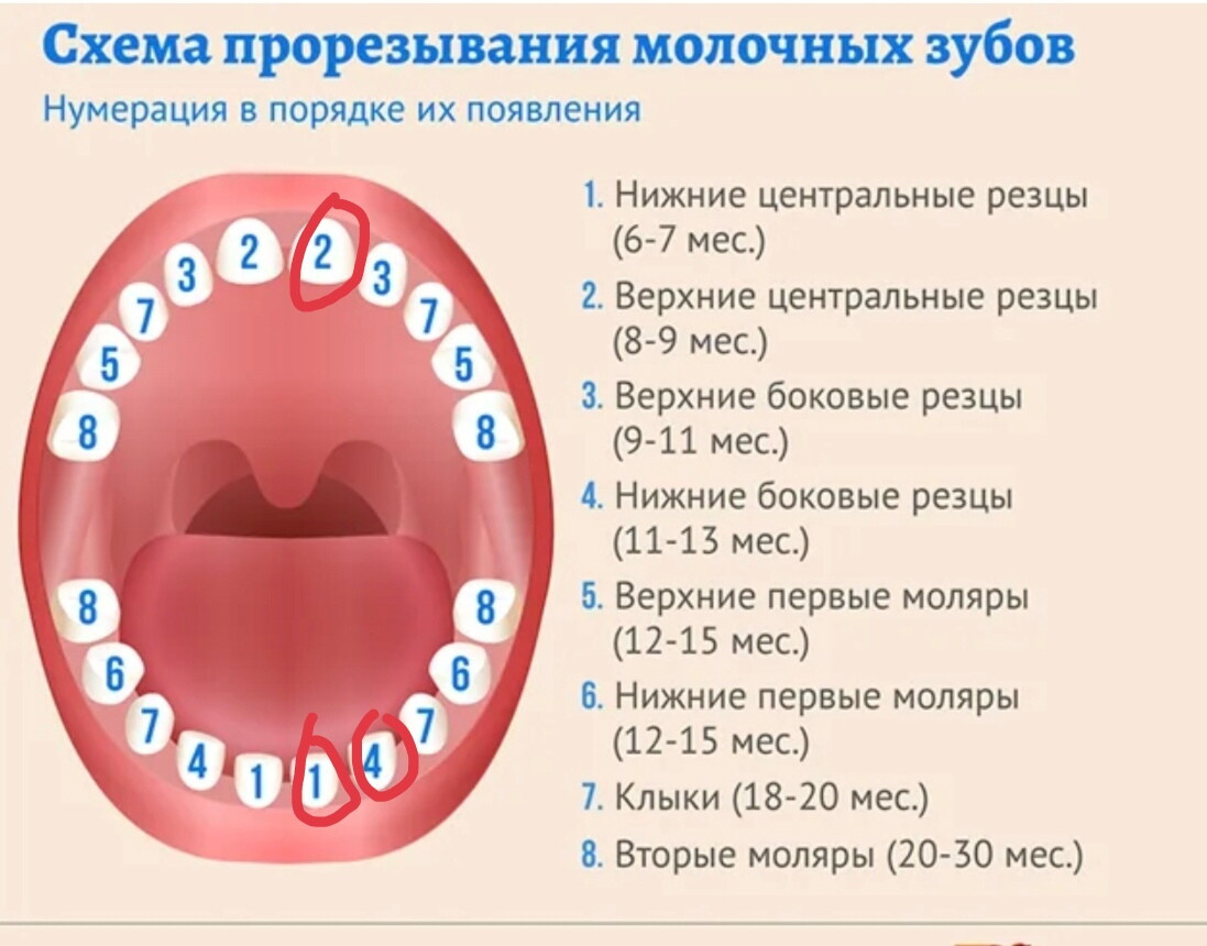 Лезут зубы неправильно, стоит ли беспокоится?