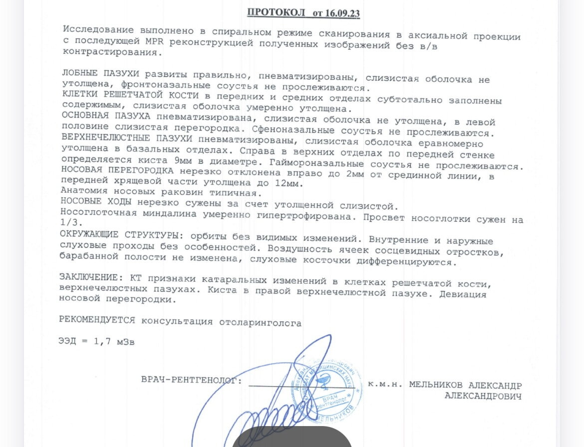 Киста в пазухе