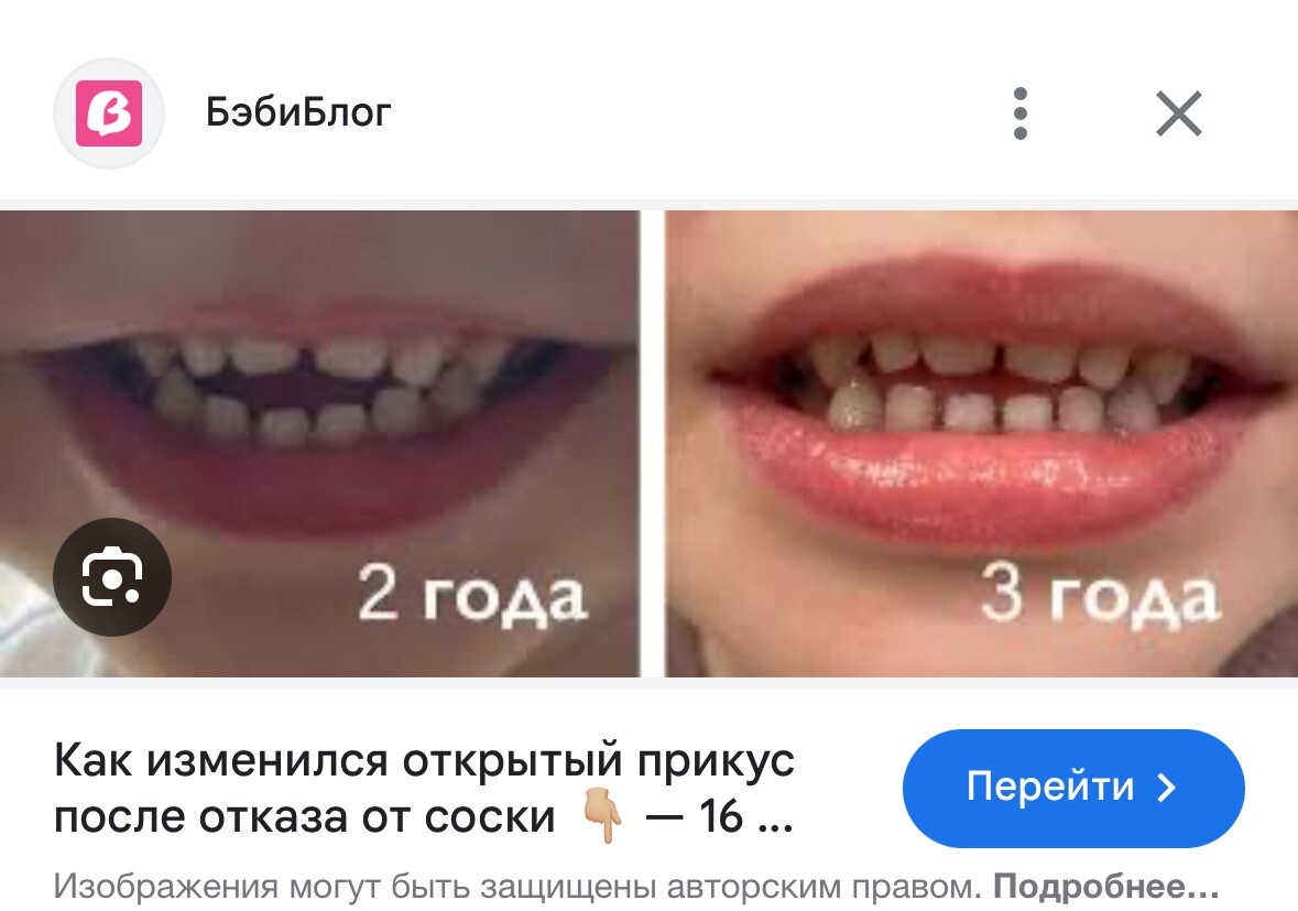 Соска, прикус