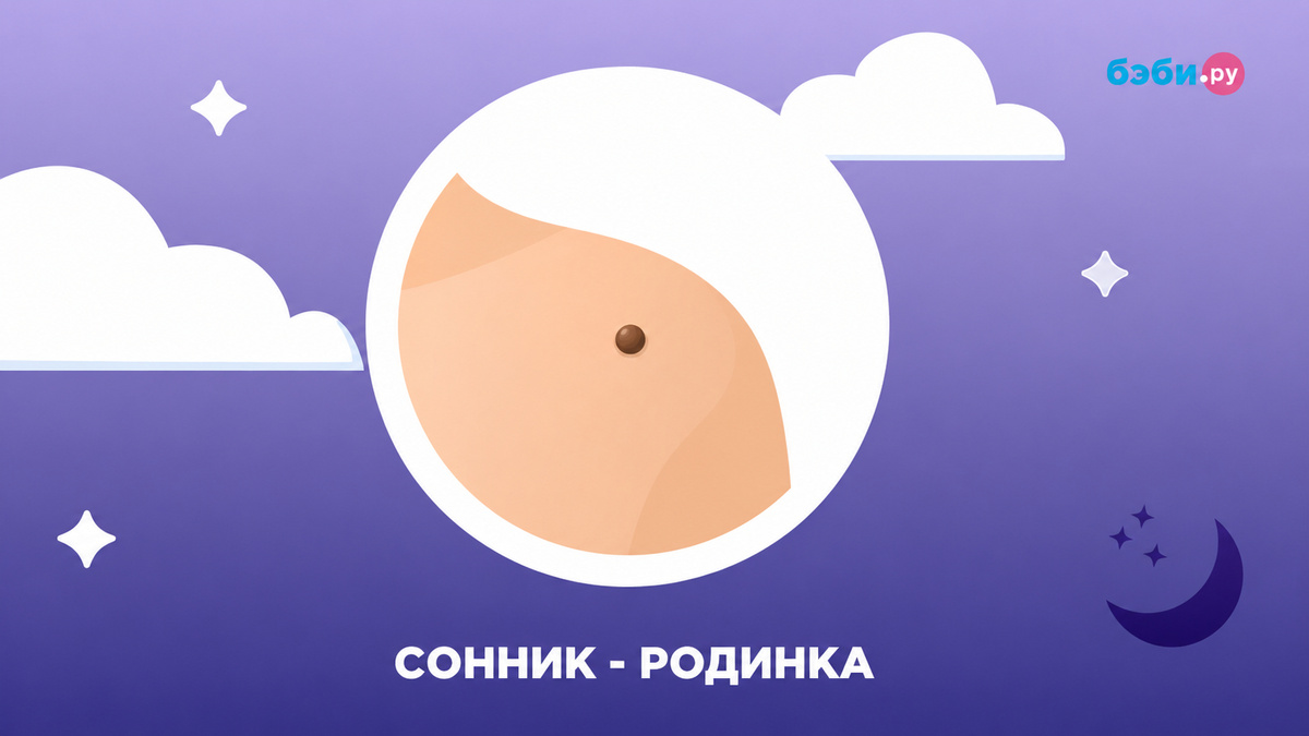 К чему снится родинка