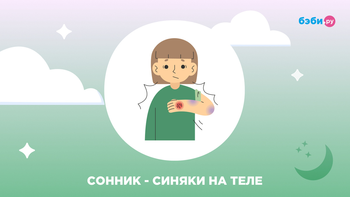 К чему снятся синяки