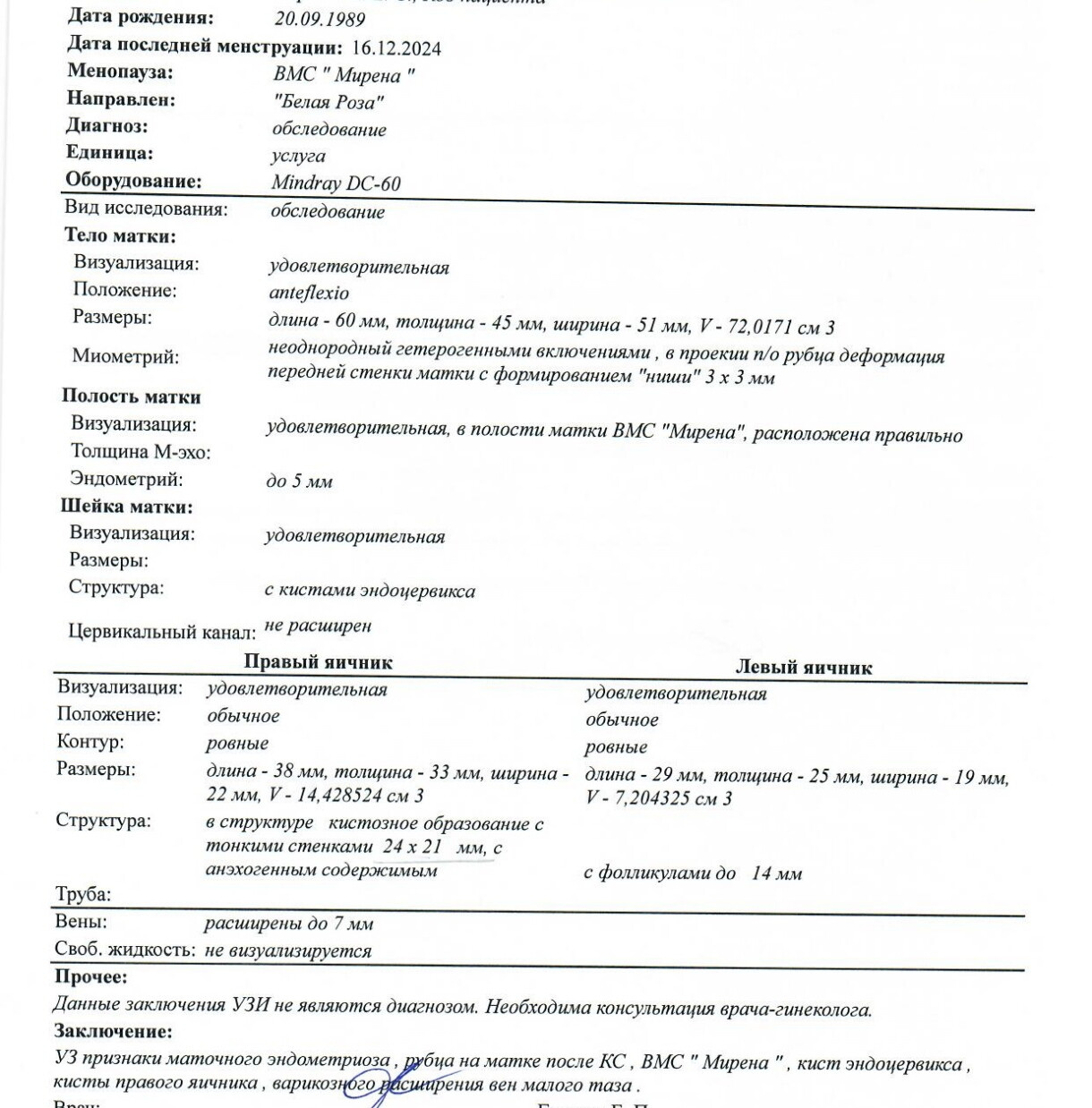 Киста яичника ( узи)