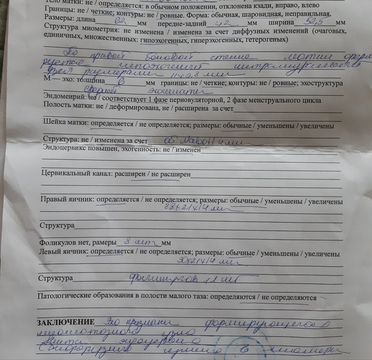 Узи