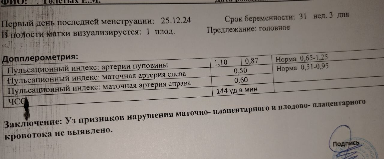 Допплер УЗИ