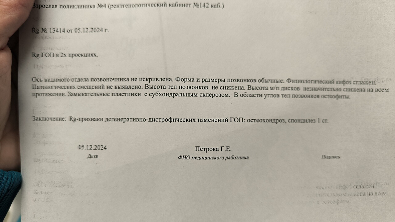 Рентген грудного отдела позвоночника