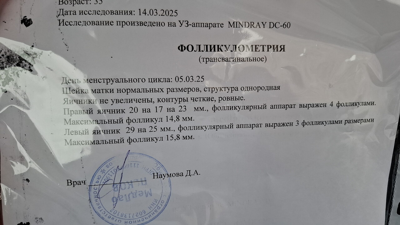 Узи