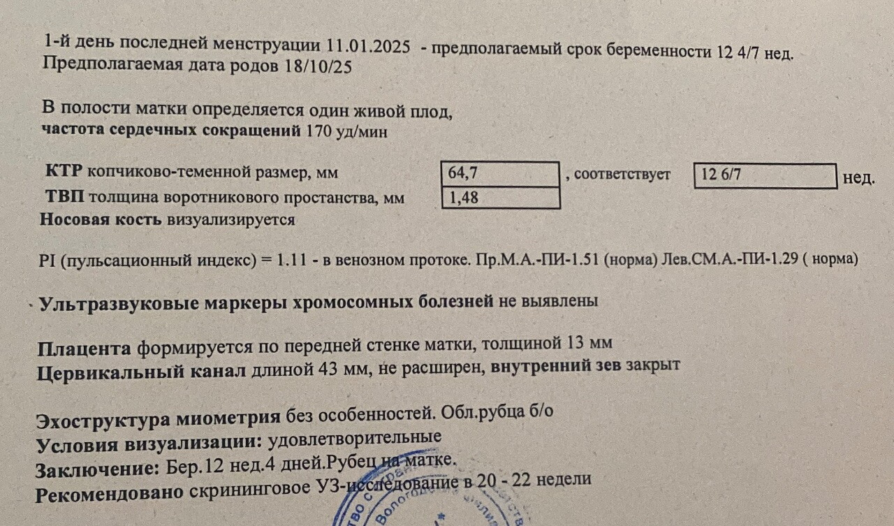 Сходила на узи