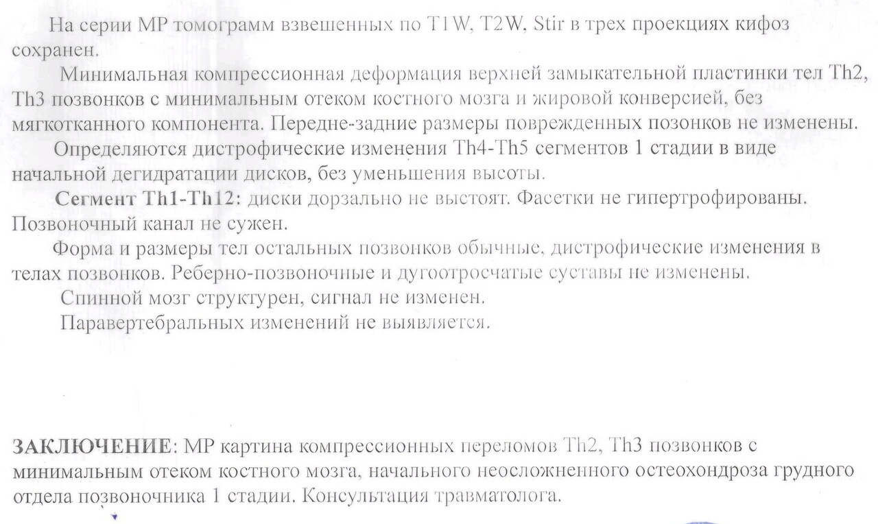 Компрессионный перелом позвонков