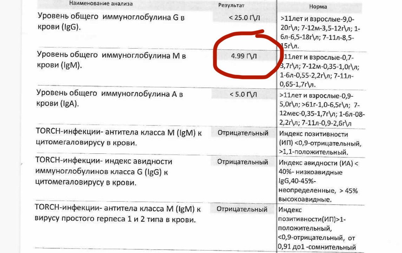Девочки меня это пугает….