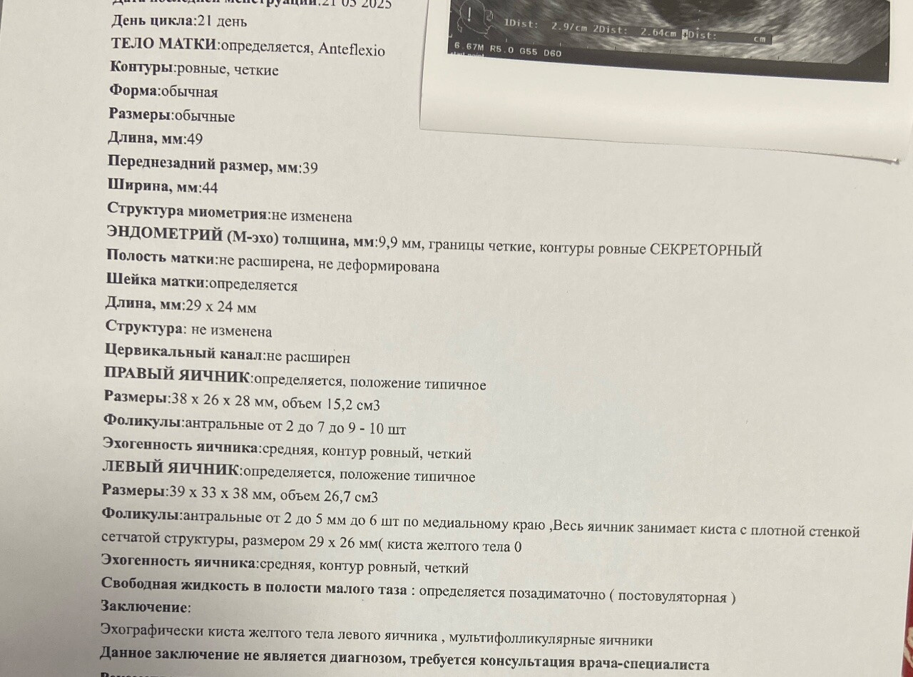 УЗИ 21дц