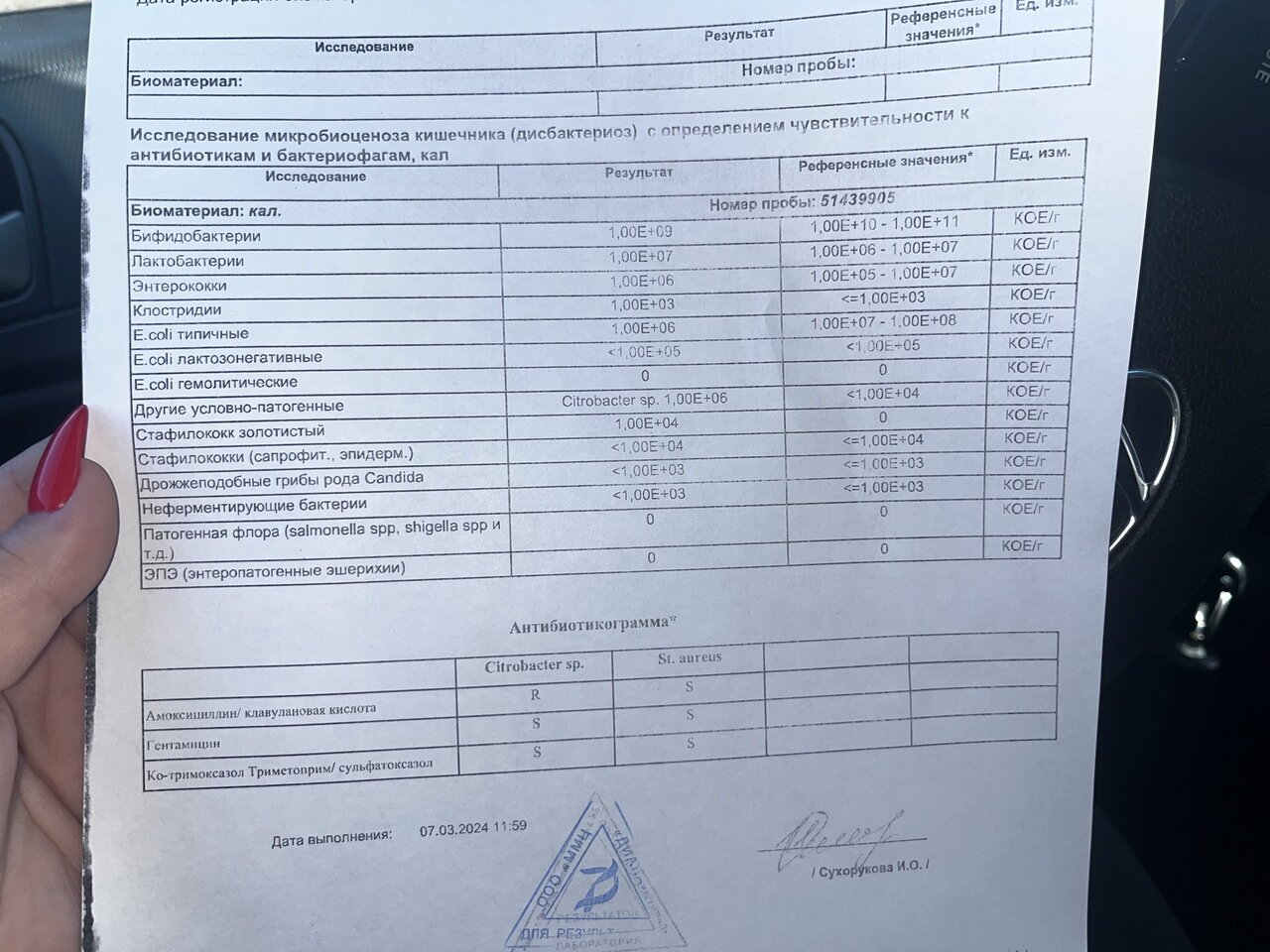 Кал на капрограмму