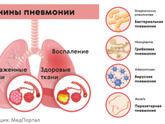 Закалять ребенка