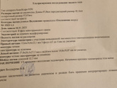 Гипоплазия