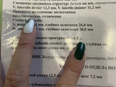 Нейросонография