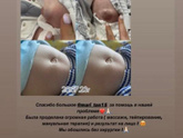У кого у малышей