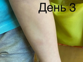 Итоги по диаскину .