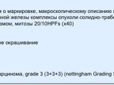 Я ниже писала, про