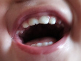 Кто лечил зубы совсем маленьким деткам 1-2 года?