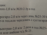 Уколы внутрисуставно при артрозе