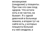 Торсомия 21 хромосомы.