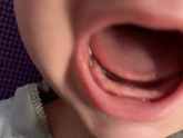 Первые зубы 🦷 ?!