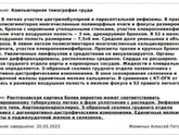 КТ лёгких туберкулёз, эмфизема, кальцинаты