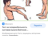 Синдром гипермобильных суставов.