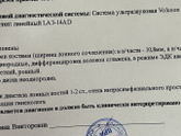 Как может такое быть? Симфизит