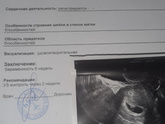 При каком размере ПЯ появился эмбрион у вас?