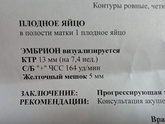 Сходила на УЗИ