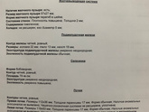 Спленомегалия у взрослого