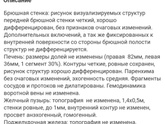 Ребенку 3 года.