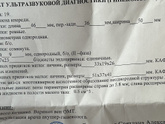 УЗИ
