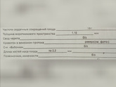 Прошла первый скрининг. 12нед и 4 дня