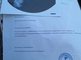 Все таки не увидели эмбрион и ЖМ