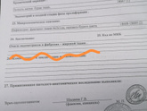 Результаты гистологии пришли.