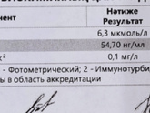 У младшей нет совсем
