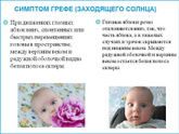 Синдром грефа