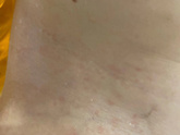 Подскажите девочки что это???? ещё выходные ни врачей ни кого нет