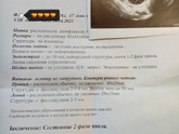 Сходила на УЗИ