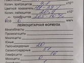 Мононуклеоз