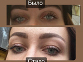 Отекают веки
