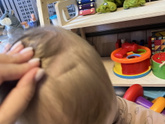У кого детям 1,4г у них гладкий череп в районе родничка?