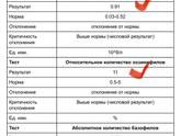 У ребенка в анализе