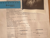 Мажет после медикаментозного аборта
