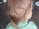 От чего могут ломаться волосы у ребенка